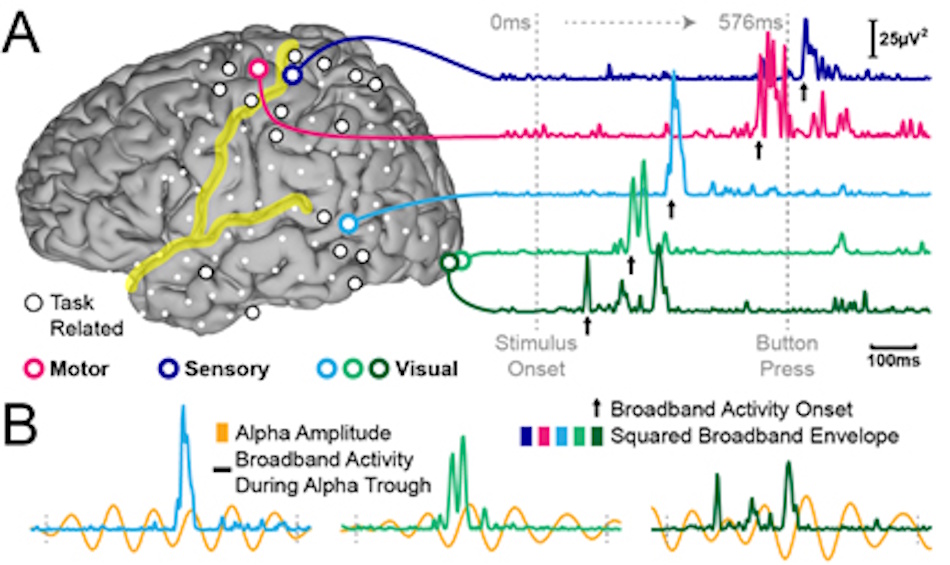 Neuroscientist Analyzing EEG Brain Activity Data Research scientist examining detailed electroencephalography data on multiple monitors displaying brain wave patterns and neural activity measurements for BCI analysis - InfoProds 2026