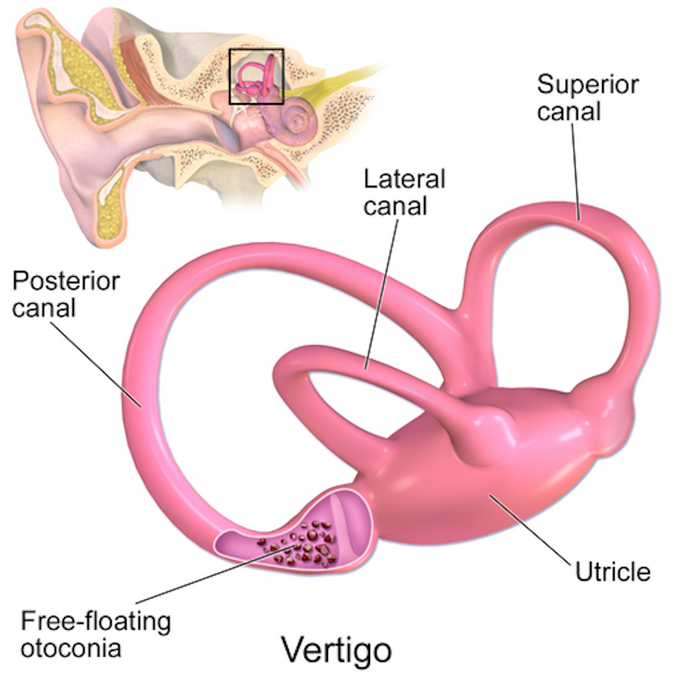 Anatomical Diagram of Human Inner Ear Vestibular System Showing Semicircular Canals Detailed anatomical illustration of human inner ear vestibular system featuring three semicircular canals, otolith organs, and neural pathways responsible for balance and spatial orientation in athletes - InfoProds Medical Science 2026